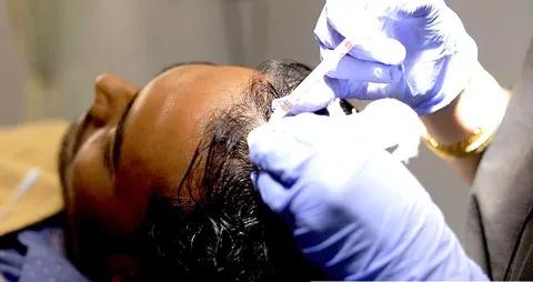 Hair Regrowth
